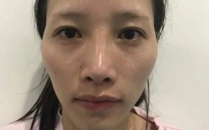 郭嘉璇脑死亡：父亲西班牙求医生不拔管，祈祷奇迹