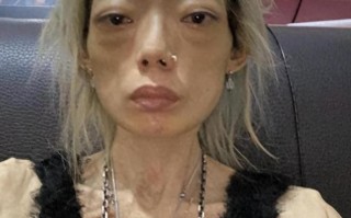 豪门玩物，8年被折磨成牙齿全掉，不足80斤，形似骷髅，惨不忍睹（豪门资产标准）