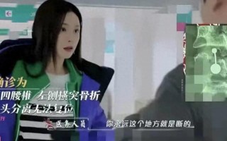 沈梦辰录节目意外受伤，腰椎骨头永久断裂引关注