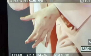 阿信F4演唱会不慎摔下舞台 手指流血仍继续演唱