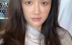 陈乔恩回应整容传闻：电波疗法无整形，支持动物公益活动