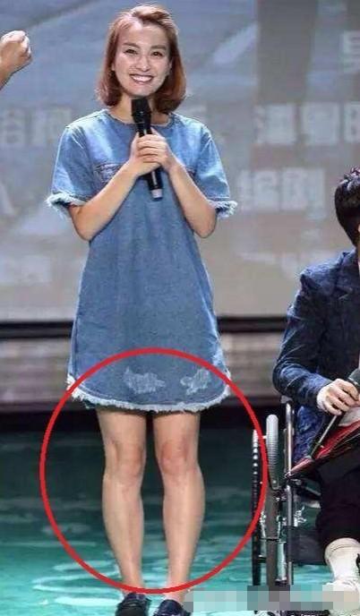 10位娱乐圈的“半截美人”,看脸绝美,但腿粗、虎背熊腰是硬伤(小说半壁文娱)-第19张图片-九妖电影 10位娱乐圈的“半截美人”,看脸绝美,但腿粗、虎背熊腰是硬伤(小说半壁文娱)-第19张图片-九妖电影