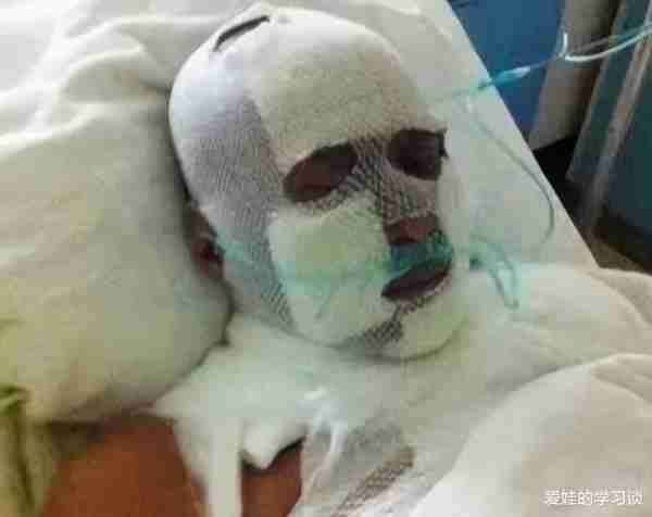 22岁荣登“春晚”一夜走红，却意外被砍缝上百针，今改行身价过亿（上5次春晚的明星）-第21张图片-九妖电影