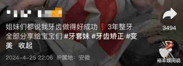 三只羊王婉葶离职！网红“小黄”自曝整牙花5万，近况曝光惹人羡（三只羊网络科技有限公司）-第2张图片-九妖电影