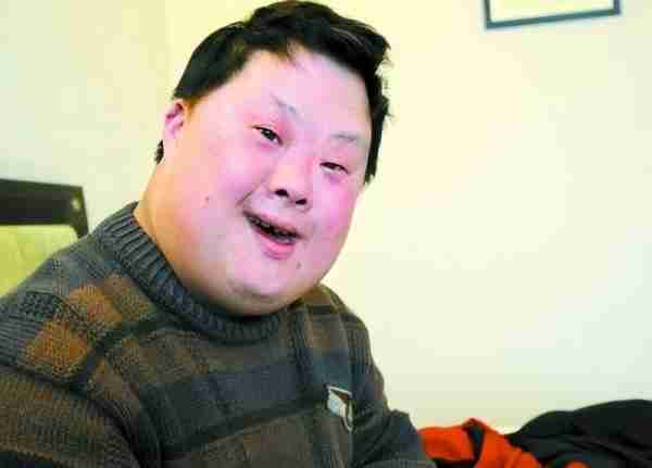 一生仅有三岁智力，却被称为天才登上春晚，如今过上了怎样的生活（智力只有3岁怎么办）-第14张图片-九妖电影