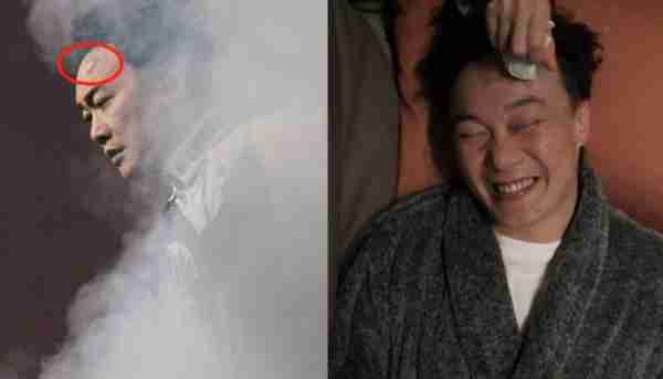 突发！陈奕迅中暑休克，晕倒致脸上骨裂缝30针，曾差点不能当父亲-第6张图片-九妖电影