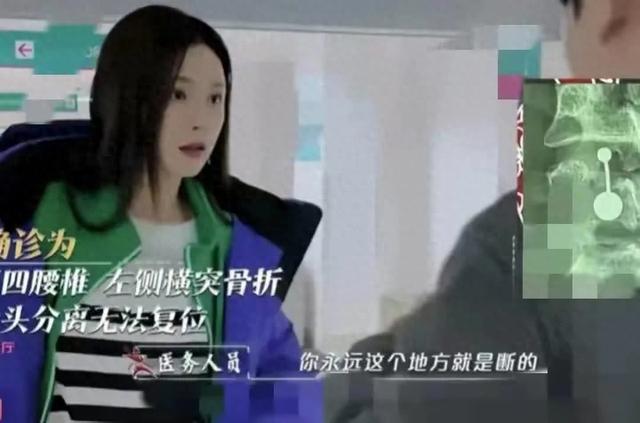 沈梦辰录节目意外受伤，腰椎骨头永久断裂引关注-第1张图片-九妖电影