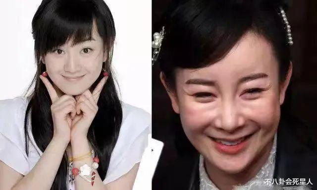 鞠婧祎近照变样，金莎脸僵浮肿，这6位明星动脸后遗症都出来了-第16张图片-九妖电影