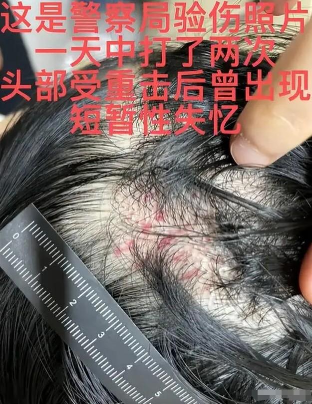 表面人模人样,实则是流氓头子,家暴恶魔,这6位男星太令人作呕-第23张图片-九妖电影 表面人模人样,实则是流氓头子,家暴恶魔,这6位男星太令人作呕-第23张图片-九妖电影