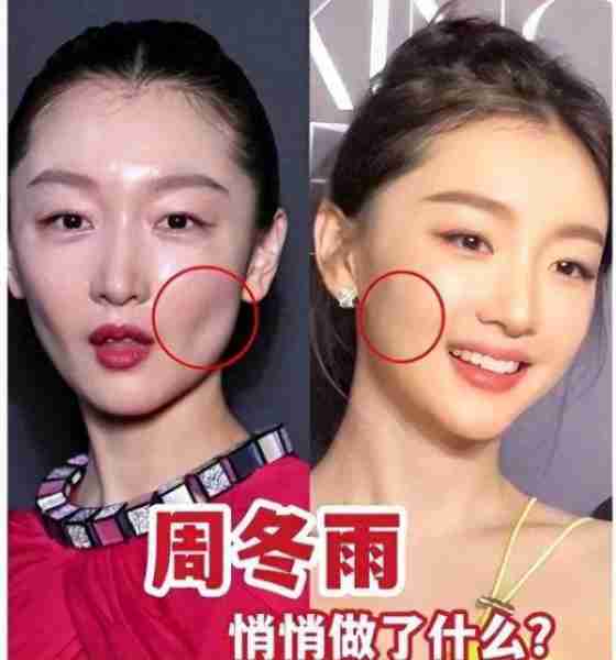 这医美做得也太残忍了!以前那个有独特辨识度的周冬雨哪去了?(周冬雨真漂亮)-第7张图片-九妖电影 这医美做得也太残忍了!以前那个有独特辨识度的周冬雨哪去了?(周冬雨真漂亮)-第7张图片-九妖电影