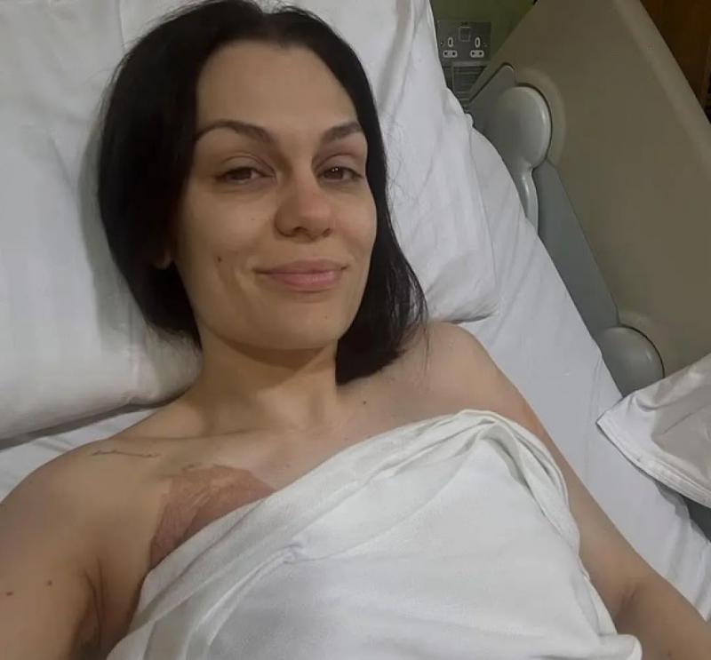 “结石姐”Jessie J分享乳腺癌术后照片：病容憔悴-第1张图片-九妖电影