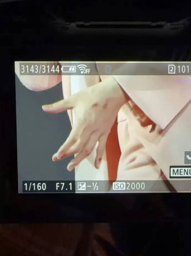 阿信F4演唱会不慎摔下舞台 手指流血仍继续演唱-第1张图片-旧杳电影网