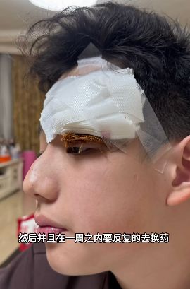 女演员深夜向儿子道歉:我一失手,他缝了四针……很多人都有这个习惯!-第3张图片-旧杳电影网 女演员深夜向儿子道歉:我一失手,他缝了四针……很多人都有这个习惯!-第3张图片-旧杳电影网