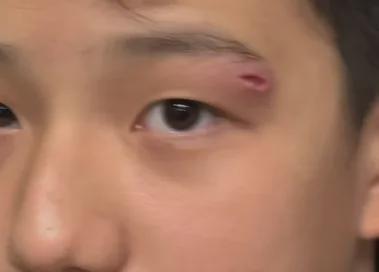 女演员深夜向儿子道歉:我一失手,他缝了四针……很多人都有这个习惯!-第2张图片-旧杳电影网 女演员深夜向儿子道歉:我一失手,他缝了四针……很多人都有这个习惯!-第2张图片-旧杳电影网