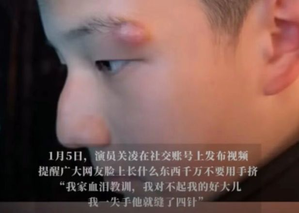 女演员深夜向儿子道歉:我一失手,他缝了四针……很多人都有这个习惯!-第1张图片-旧杳电影网 女演员深夜向儿子道歉:我一失手,他缝了四针……很多人都有这个习惯!-第1张图片-旧杳电影网